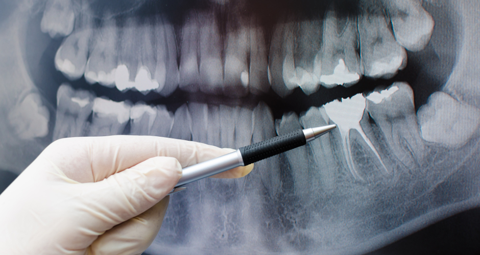 Dentist showing something on dental x-ray image on computer monitor.